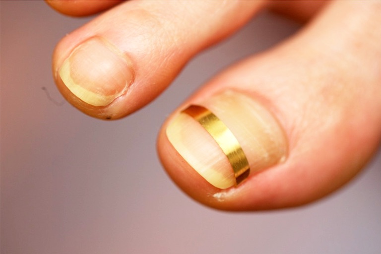 足つぼ＋脛＋膝＋ふくらはぎ＋頭・顔・首肩・肩甲骨